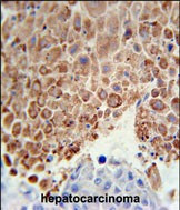 PHGDH Antibody in Immunohistochemistry (Paraffin) (IHC (P))