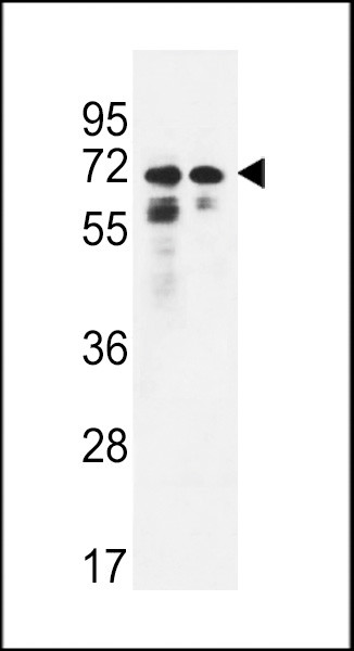 PNPLA8 Antibody in Western Blot (WB)