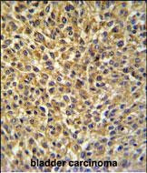 CRIP1 Antibody in Immunohistochemistry (Paraffin) (IHC (P))