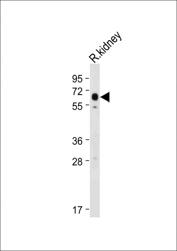 SLC47A2 Antibody in Western Blot (WB)