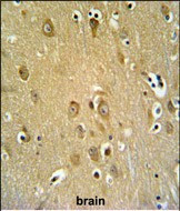 SYTL2 Antibody in Immunohistochemistry (Paraffin) (IHC (P))