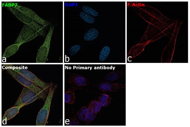 FABP7 Antibody in Immunocytochemistry (ICC/IF)