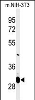 MAGT1 Antibody in Western Blot (WB)