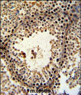 PHF13 Antibody in Immunohistochemistry (Paraffin) (IHC (P))