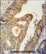 BTG1 Antibody in Immunohistochemistry (Paraffin) (IHC (P))