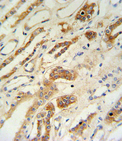 ZFYVE16 Antibody in Immunohistochemistry (Paraffin) (IHC (P))