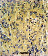 TESC Antibody in Immunohistochemistry (Paraffin) (IHC (P))