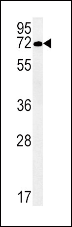 SLC19A3 Antibody in Western Blot (WB)