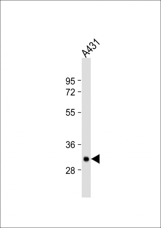 Tryptase Antibody in Western Blot (WB)