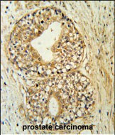 ATP11C Antibody in Immunohistochemistry (Paraffin) (IHC (P))