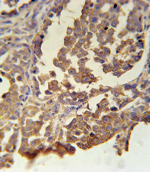 MC2R Antibody in Immunohistochemistry (Paraffin) (IHC (P))