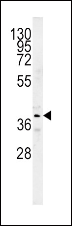 SRD5A2 Antibody in Western Blot (WB)