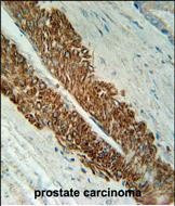 STEAP2 Antibody in Immunohistochemistry (Paraffin) (IHC (P))