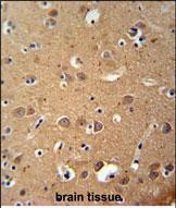 ZDHHC2 Antibody in Immunohistochemistry (Paraffin) (IHC (P))