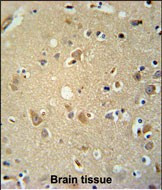 P2X7 Antibody in Immunohistochemistry (Paraffin) (IHC (P))