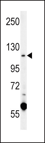 CACNA2D4 Antibody in Western Blot (WB)