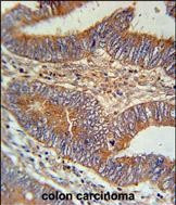 BIN2 Antibody in Immunohistochemistry (Paraffin) (IHC (P))