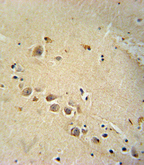 RASGRP1 Antibody in Immunohistochemistry (Paraffin) (IHC (P))