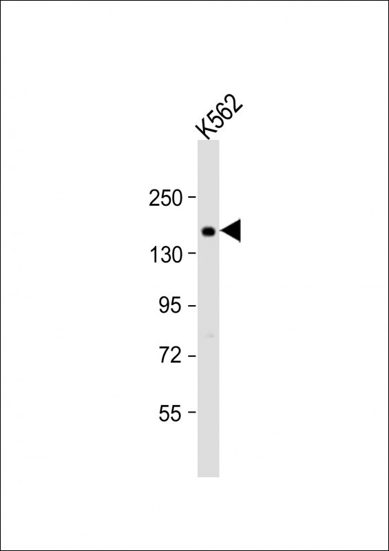 ADCY10 Antibody in Western Blot (WB)