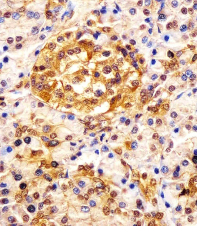 ESRP1 Antibody in Immunohistochemistry (Paraffin) (IHC (P))