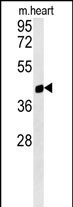 PTGR1 Antibody in Western Blot (WB)