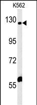 IQSEC3 Antibody in Western Blot (WB)