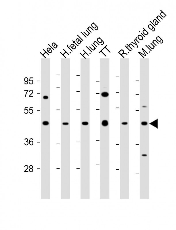 Nkx2.1 Antibody in Western Blot (WB)