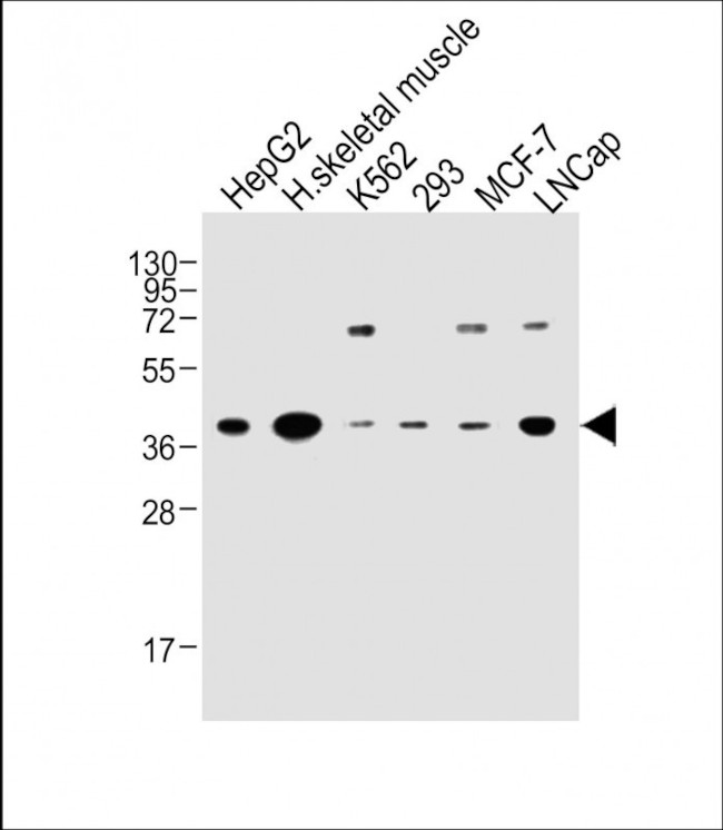 OR2H2 Antibody in Western Blot (WB)