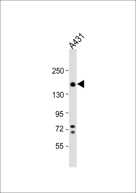 ITGA2 Antibody in Western Blot (WB)