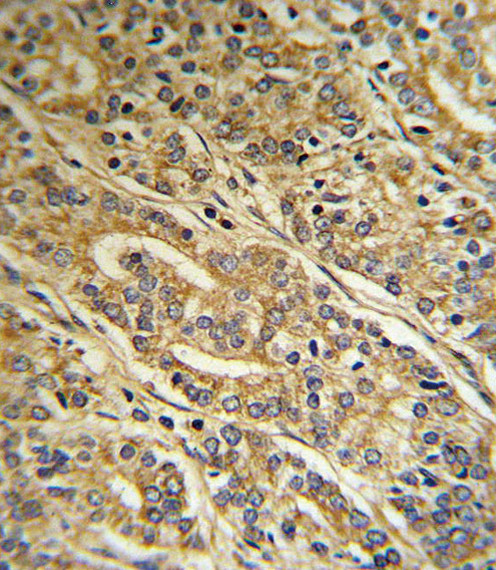 ACOT8 Antibody in Immunohistochemistry (Paraffin) (IHC (P))