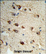 Fibromodulin Antibody in Immunohistochemistry (Paraffin) (IHC (P))