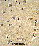 PLCB2 Antibody in Immunohistochemistry (Paraffin) (IHC (P))