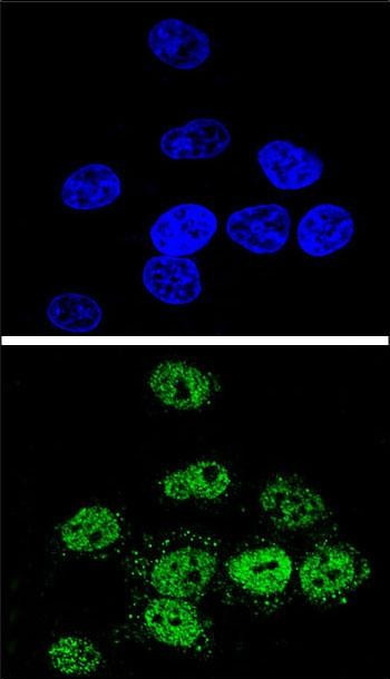 MEF2A Antibody in Immunocytochemistry (ICC/IF)