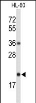 RNaseH2C Antibody in Western Blot (WB)