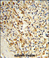 LPCAT1 Antibody in Immunohistochemistry (Paraffin) (IHC (P))