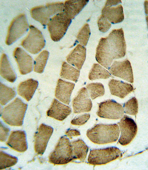 PARVA Antibody in Immunohistochemistry (Paraffin) (IHC (P))