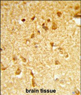 DDX17 Antibody in Immunohistochemistry (Paraffin) (IHC (P))