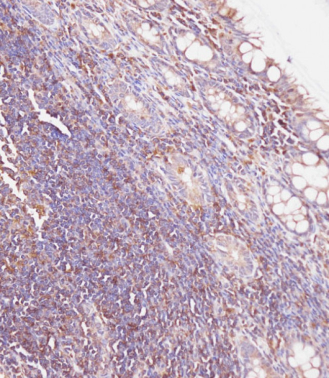 GUSB Antibody in Immunohistochemistry (Paraffin) (IHC (P))