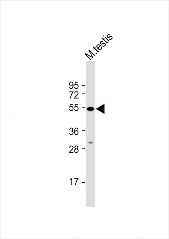 ORAI1 Antibody in Western Blot (WB)