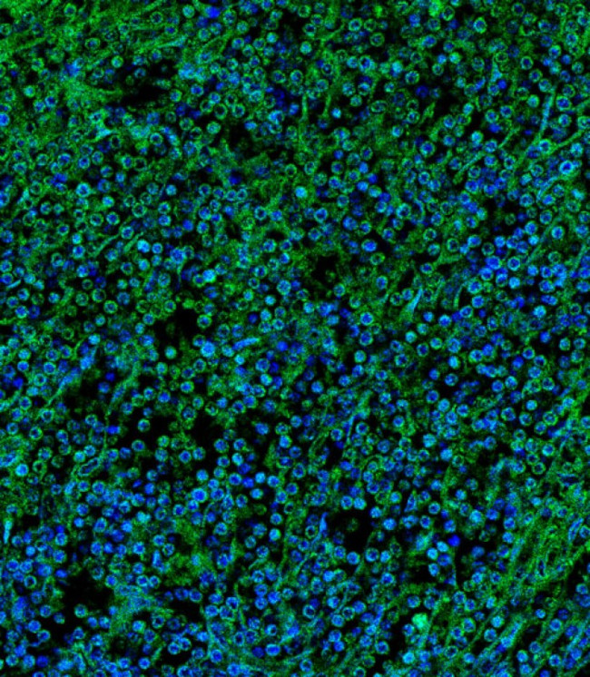 IL2RG Antibody in Immunohistochemistry (PFA fixed) (IHC (PFA))