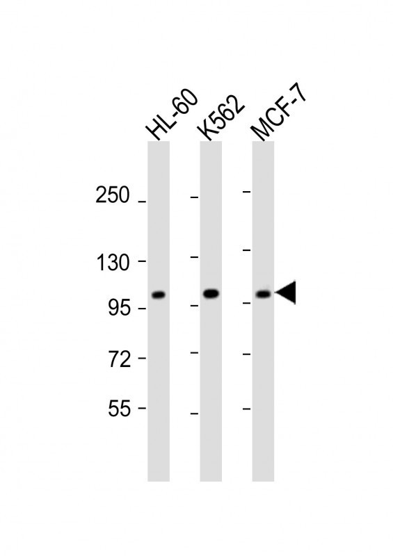 GEN1 Antibody in Western Blot (WB)