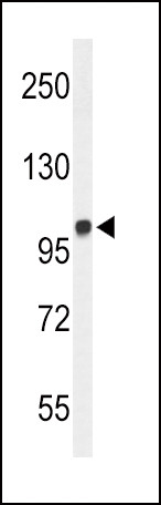 MICAL2 Antibody in Western Blot (WB)