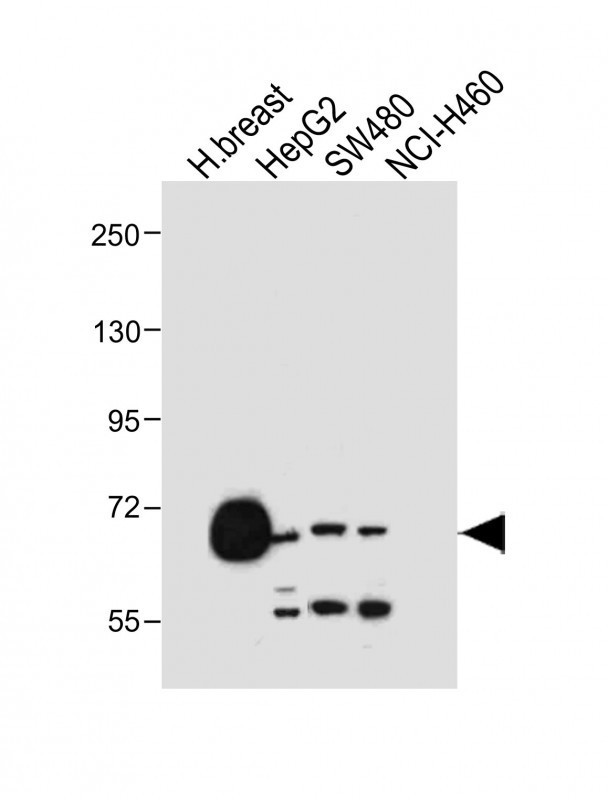 OATP2 Antibody in Western Blot (WB)