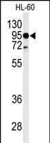 TLR4 Antibody in Western Blot (WB)