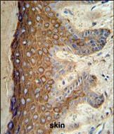 Cytokeratin 1 Antibody in Immunohistochemistry (Paraffin) (IHC (P))