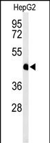 HFE2 Antibody in Western Blot (WB)