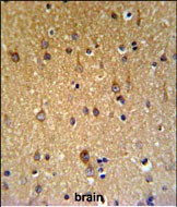 ZDHHC9 Antibody in Immunohistochemistry (Paraffin) (IHC (P))