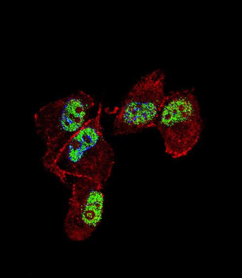 ZNF202 Antibody in Immunocytochemistry (ICC/IF)