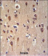 GRPR Antibody in Immunohistochemistry (Paraffin) (IHC (P))