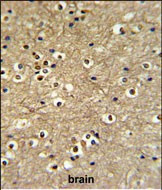 ETS2 Antibody in Immunohistochemistry (Paraffin) (IHC (P))